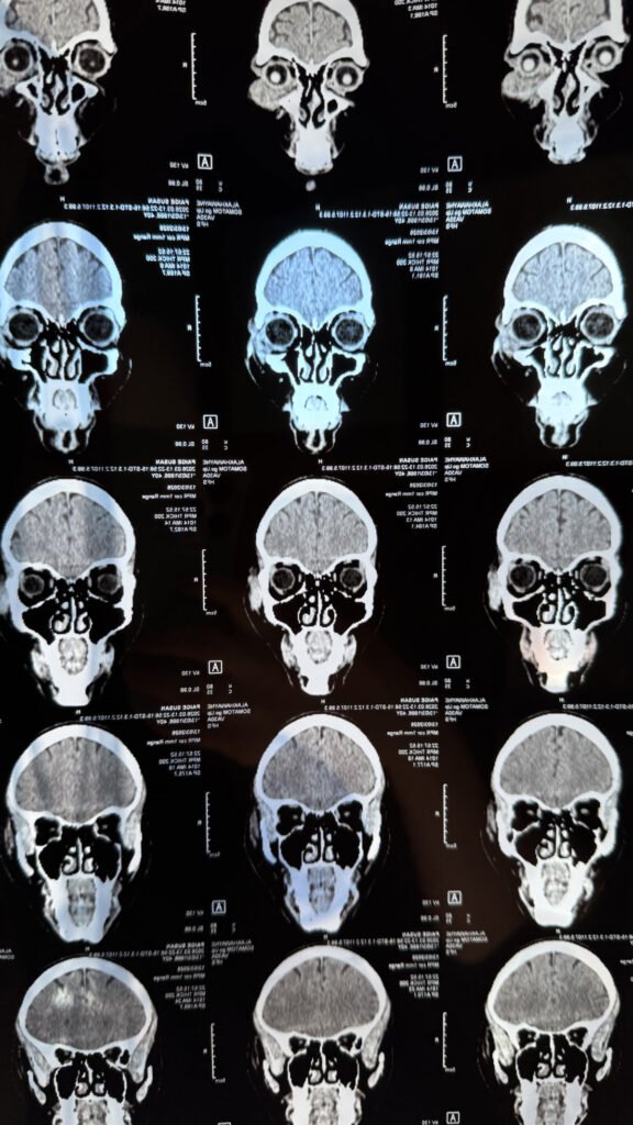 MRI scan after Kitesurf injury