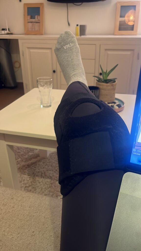 Torn MCL & LCL ligament knee injury